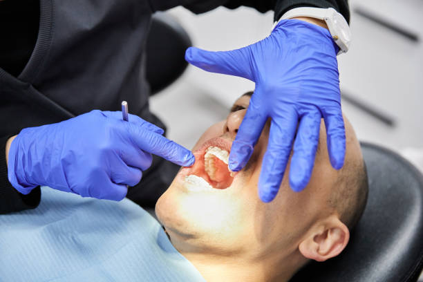 Best Knocked-Out Tooth (Avulsed Tooth) Treatment in Liberty, SC